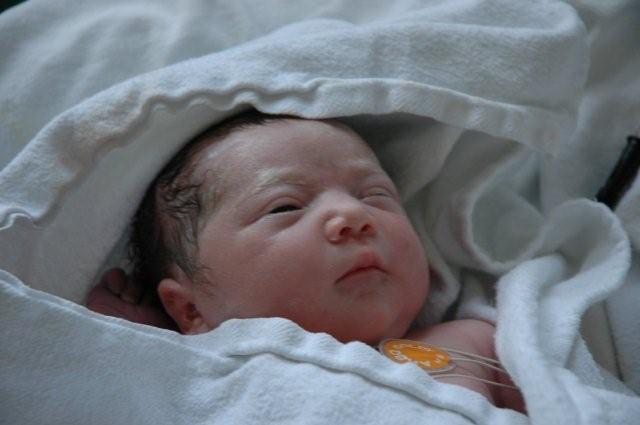 After birth - Click to enlarge